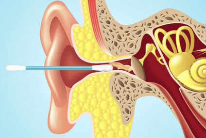 Conseil du jour : évitez le coton-tige