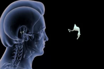 L’otospongiose : quand un tout petit os de l’oreille freine l’audition